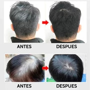SHAMPOO - CUBRE CANAS | ENVIÓ GRATIS A TODO PERÚ